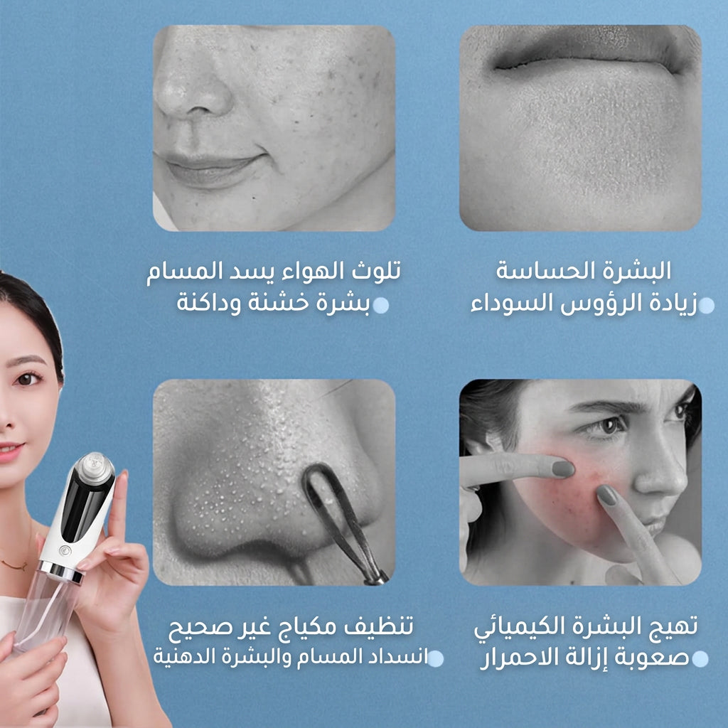 Blackhead Remover Pore Vacuum