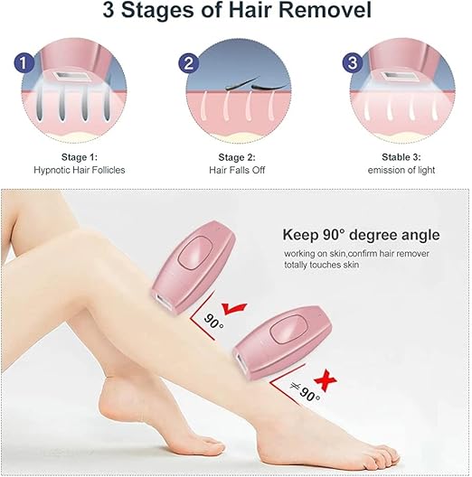 IPL Hair Removal Device